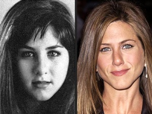cirugía estética y Jennifer Aniston