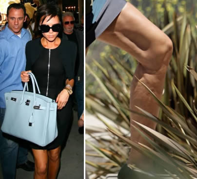 Celulitis famosas: Victoria Beckham con celulitis