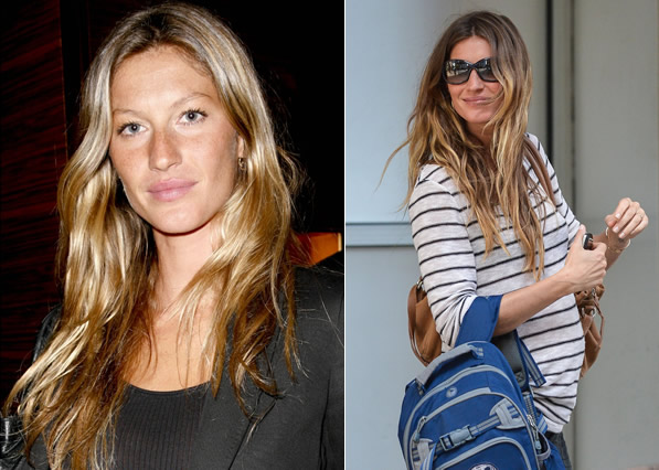 Gisele Bundchen: ciruga esttica