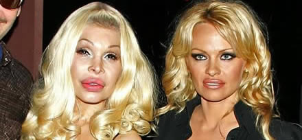 Cirugía famosas: Pamela Anderson y Amanda Lepore