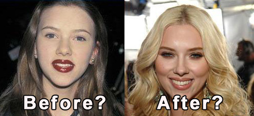 Cirugía famosas: Scarlett Johansson y Cirugía estética